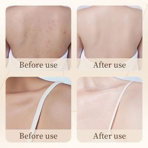 Set <span class=keywords><strong>de</strong></span> Cuidado <span class=keywords><strong>de</strong></span> la Piel con Arroz Integral BIOAUQA, Productos <span class=keywords><strong>de</strong></span> Belleza, Jabón Exfoliante, Crema Blanqueadora Hidratante, Gel <span class=keywords><strong>de</strong></span> Ducha, Mascarilla Capilar, <span class=keywords><strong>Kit</strong></span> <span class=keywords><strong>de</strong></span> Cuidado <span class=keywords><strong>Facial</strong></span> - Product Image 5