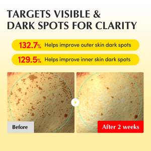 Crema Illuminante con Vitamina, Retinolo 5%, Niacinamide 3%, TXA, Ceramide, Riduzione Macchie Scure, Crema Anti-Età per Tutti i Tipi di Pelle - Product Image 3