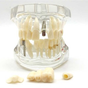 Modelo de Dientes en Oferta, Modelo de Prótesis Dental Estándar para Adultos, Modelo de Demostración para Niños - Product Image 5