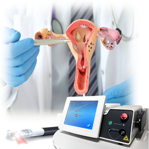 Dispositivo Laser cosmetico per ginecologia da 980nm 1470nm Non chirurgico portatile macchina Laser a diodi di ringiovanimento vaginale Laser medicale LVR - Product Image 1