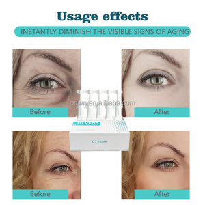 Crema <span class=keywords><strong>Contorno</strong></span> <span class=keywords><strong>de</strong></span> <span class=keywords><strong>Ojos</strong></span> con Colágeno OTVENA, Efecto Lifting Instantáneo, Reafirma la Piel Flácida, Elimina las Líneas Finas <span class=keywords><strong>de</strong></span> Expresión, Cuidado Diurno y Nocturno - Product Image 6