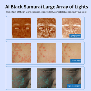 Dispositivo di Bellezza Intelligente a Controllo Vocale per Anti-infiammazione, Riparazione, Sbiancamento e Schiarimento delle Macchie Scure sul Viso - Product Image 5