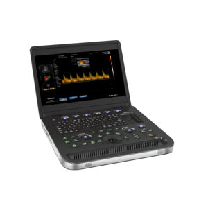 Máquina de Ultrassom Veterinário Portátil à Venda, Scanner de Ultrassom B para Uso em Fazendas de Gado e Equinos - Product Image 3