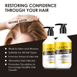 Shampooing <span class=keywords><strong>pour</strong></span> la croissance des cheveux Lichen <span class=keywords><strong>pour</strong></span> hommes et femmes, sans sulfate, <span class=keywords><strong>meilleur</strong></span> shampooing et revitalisant <span class=keywords><strong>pour</strong></span> la croissance des cheveux - Product Image 4