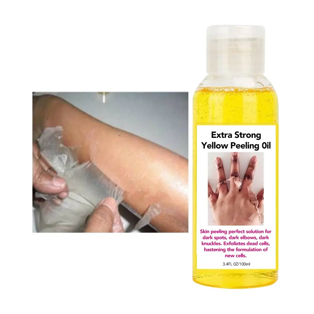 Best new skin whitening yellow peeling oil wholesale lightening extra strong extra peeling oil for body