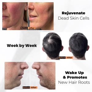 เข็ม140สำหรับผู้หญิงและผู้ชายการเติบโตของร่างกายและเส้นผมและเคราที่ใช้ในบ้านขนาด0.25มม. - Product Image 5