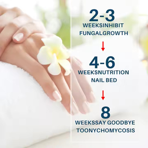 랜섬 네일 곰팡이 제거 크림 Onychomycosis 곰팡이 치료 손발톱 감염 방지 발 곰팡이 관리 연고
