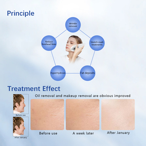 Appareil de beauté DEEPBA : Électroporation dermique non invasive pour une introduction efficace des produits de soin dans la peau - Product Image 4