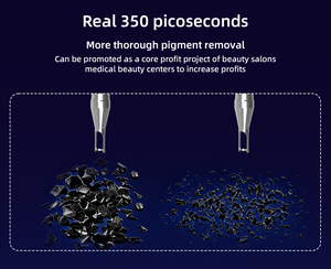 Máquina de Eliminación de Manchas de Piel con Láser de Picosegundos, Máquina de Belleza <span class=keywords><strong>para</strong></span> Eliminar Manchas, Pecas y <span class=keywords><strong>Verrugas</strong></span> <span class=keywords><strong>para</strong></span> Salones de Belleza, Picolaser Medic - Product Image 5