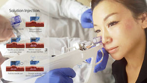 Sistema di Iniezione Automatica INTROFILL, Pistola per Mesoterapia per Corpo e Viso con Certificazione CE Medicale - Product Image 6
