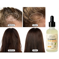 OEM ODM Minyak Rambut Herbal Vegan untuk Pertumbuhan & Mengatasi Kerontokan Rambut dengan Peptida Alami untuk Pertumbuhan & Perbaikan Rambut Label Pribadi