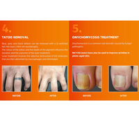 Superlaser SL-HRF1 1064nm Laser Nd:YAG à impulsions longues pour l'épilation et le traitement vasculaire, équipement de beauté avec système de refroidissement par contact