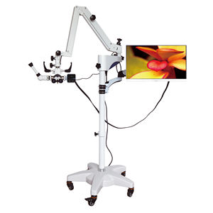 Otolaryngologie ORL Opération Microscope Neurochirurgie Cerveau Chirurgie Ophtalmique Microscope Chirurgical Électrofocalisé pour Hôpital - Product Image 2