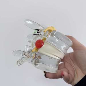 Modelo de Demostración de Extrusión de Columna Vertebral y Médula Espinal, Modelo de Enseñanza Médica Humana, Bola de Burbuja de Médula Espinal - Product Image 1