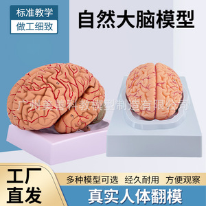 Modèle de cerveau humain, modèle de vaisseaux sanguins cérébraux, modèle d'anatomie du cerveau, modèle pédagogique médical de crâne humain (peut être démonté) - Product Image 5