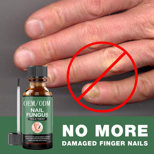 Traitement pour les ongles, accessoire de pédicure pour les pieds et les orteils, traitement pour les doigts et les orteils, Nail-art, 120 pièces - Product Image 2