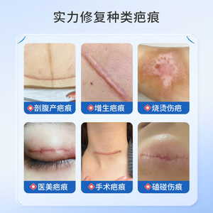 Parche de gel de silicona para cicatrices de 0.25 mm de grosor, reutilizable para mejorar las cicatrices postoperatorias y cuidado de la atenuación de las marcas. - Product Image 4