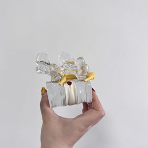 Modelo de Demostración de Extrusión de Columna Vertebral y Médula Espinal, Modelo de Enseñanza Médica Humana, Bola de Burbuja de Médula Espinal - Product Image 6