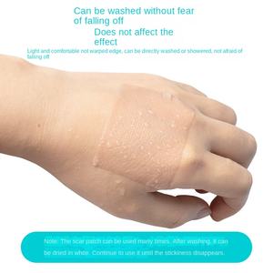 Processamento De Silicone Pós-operatório Cicatriz <span class=keywords><strong>Patch</strong></span> Pack Impermeável e Sweatproof Cicatriz Hiperplasia Cicatriz <span class=keywords><strong>Patch</strong></span> - Product Image 4
