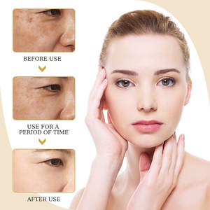 Venta al por mayor muy eficaz de la piel blanqueamiento de glutatión cara crema - Product Image 6