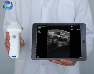 Échographe portable sans fil à très haute fréquence 20 MHz pour l'analyse avancée des couches cutanées et la cartographie esthétique du visage - Product Image 3