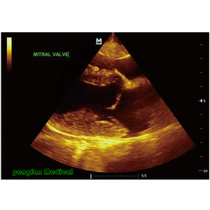 Sistema de Ultrasonido Veterinario <span class=keywords><strong>Mindray</strong></span> M6Vet Plateado, Enchufe Eléctrico de Acero para Mascotas Pequeñas - Product Image 2