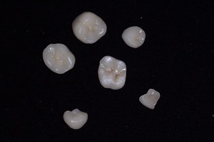 <span class=keywords><strong>Horno</strong></span> de Prensado <span class=keywords><strong>Dental</strong></span> Automático para Bloques de Cerámica IPS E.max, <span class=keywords><strong>Horno</strong></span> de Sinterización para Laboratorio <span class=keywords><strong>Dental</strong></span>, <span class=keywords><strong>Horno</strong></span> de Prensado de <span class=keywords><strong>Porcelana</strong></span> - Product Image 6
