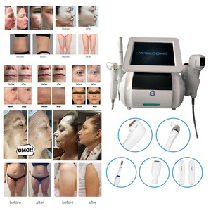 Dispositivo de Belleza Profesional 5 en 1 para Reafirmar y Rejuvenecer la Piel, ABS, para el Cuidado Facial y Corporal, 2026 - Product Image 4