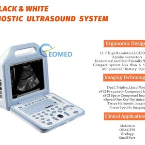 Échographe portable le moins cher, imagerie numérique complète, appareil à ultrasons pour la grossesse et la médecine vétérinaire BW21B - Product Image 2