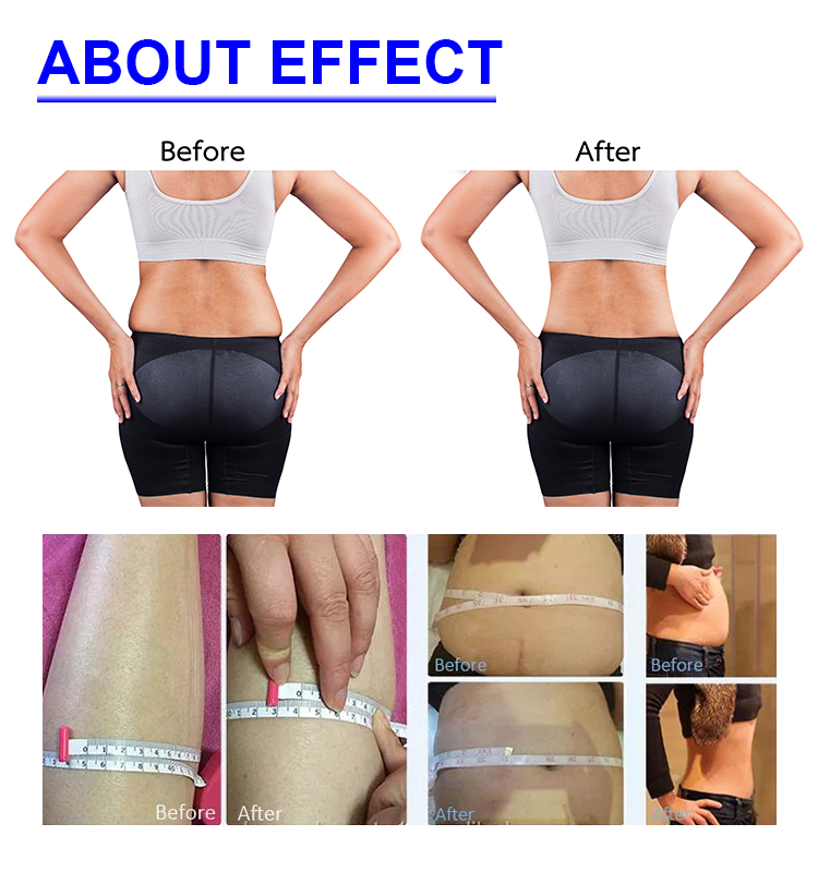 Xinlei Esthetic Beauty Machine