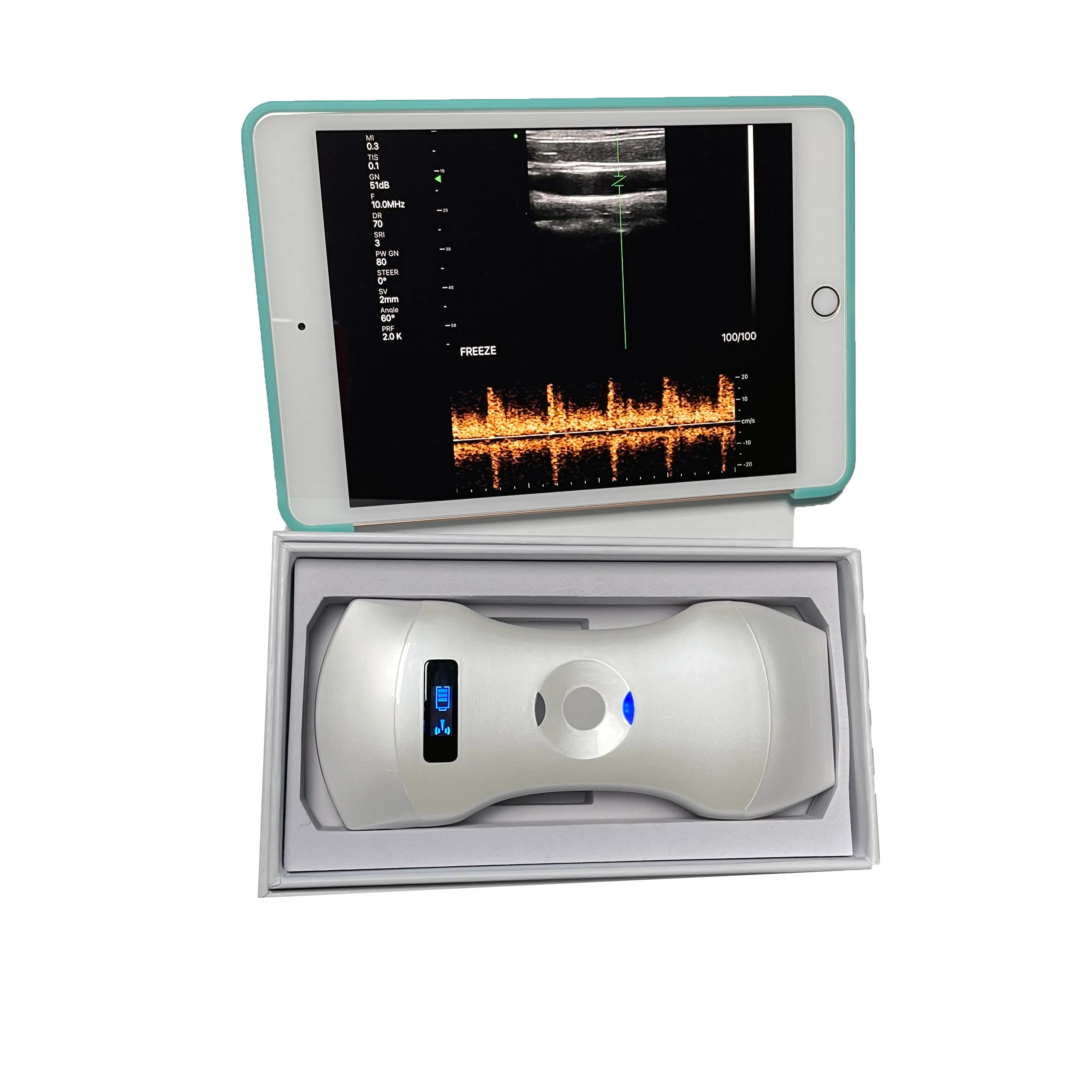 Sonostar Draadloze Dubbele Probe Echografie Handheld Bolle Lineaire Kleur Doppler Ultrasound Probe Scanner MSLAA114