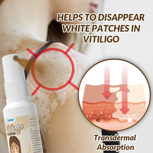Sumifun New White Spot Remove Spray Herbal Vitiligo Repair Vitiligo Treatment Spray 30ml - Product Image 3
