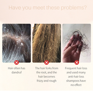 Bulk Private Label Pure Cold Press Organic <strong>Castor</strong> <strong>Oil</strong> for Hair Eyelash Eyebrow Growth 10ml <strong>Jamaican</strong> <strong>Black</strong> <strong>Castor</strong> Essential <strong>Oil</strong> - Product Image 3