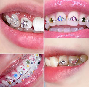 Offre Spéciale : Kit de Décoration Dentaire avec Bijoux de Dents, Lampe de Polymérisation et Colle, Strass Dentaires en Cristal Solide Swarovski - Product Image 3