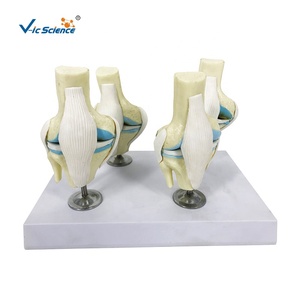 Modelo Anatómico <span class=keywords><strong>de</strong></span> <span class=keywords><strong>Huesos</strong></span> <span class=keywords><strong>Humanos</strong></span>, Esqueleto <span class=keywords><strong>de</strong></span> Rodilla con 4 Etapas <span class=keywords><strong>de</strong></span> Osteoartritis, para Uso en la Escuela <span class=keywords><strong>de</strong></span> Medicina, Modelo <span class=keywords><strong>de</strong></span> Esqueleto Humano, Modelo <span class=keywords><strong>de</strong></span> Articulación <span class=keywords><strong>de</strong></span> Rodilla - Product Image 1