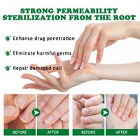 JAYSUING Soin des mains et des pieds 7 jours Traitement contre les champignons des ongles Sérum fongique des cuticules 30ml