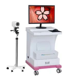 Видео кольпоскоп эндоскоп камера медицинская верхняя цифровая цветная видеокамера электронный кольпоскоп медицинская гинекология
