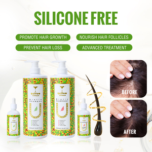 Set de Crecimiento Capilar con Aceite de Romero Herbal Personalizado, Marca Privada, Champú de Aceite de Ricino Orgánico para el Crecimiento del Cabello, Set de Productos para el Crecimiento del Cabello - Product Image 2