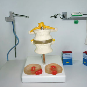 Modèle anatomique de la colonne vertébrale humaine avec deux disques intervertébraux lombaires et deux lésions Matériau en PVC Structure anatomique vive - Product Image 6