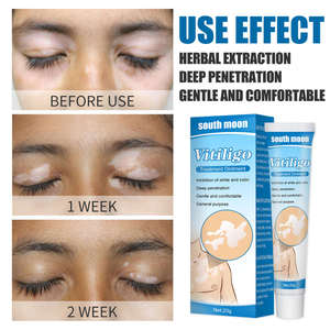 Crema para Manchas Blancas de TikTok, Crema para el Tratamiento de la Psoriasis, Vitíligo Localizado, Micosis y Leucoplasia - Product Image 5