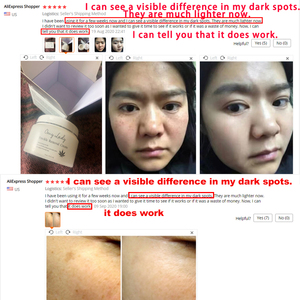 Produits professionnels de soins de la peau 2022, livraison directe, crème anti-rides pour le visage, lotion de soins de la peau - Product Image 4
