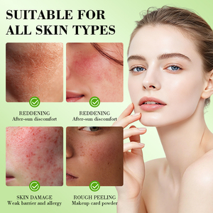 Crème visage apaisante à l'aloe vera et au PDRN pour peaux sensibles, marque privée, reconstitue la barrière cutanée et apaise les rougeurs, crème OEM. - Product Image 3
