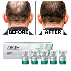 Nouveau produit 2026 : Masque SRLV Asce Cream pour le soin de la peau, les cicatrices d'acné et la repousse des cheveux - Product Image 5