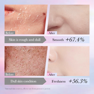 Maschera Viso Sbiancante OEM SADOER per Illuminare la Pelle con Niacinamide ed Essenza Idratante - Product Image 3