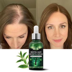 Natürliches Haarausfall-Behandlungs serum mit <span class=keywords><strong>Biotin</strong></span>-Ingwer-Teebaumex trakt Bio-Vegan-Formel für beschädigte Haar reparatur - Product Image 1