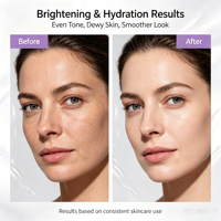 Gel blanchissant Capsule crème hydratante en profondeur éclaircissant améliorer les taches brunes barrière réparation crème pour