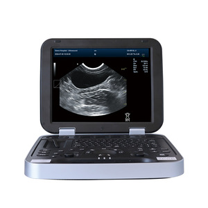 Máquina de Ultrasonido Veterinaria Portátil Promax de 15 Pulgadas con Batería de Litio para Mascotas - Product Image 3