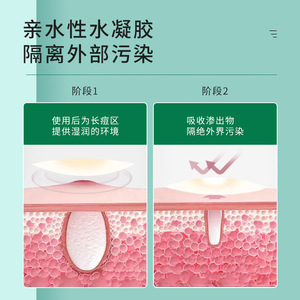 Acne Patch Round Individual Pack <b>Transparent</b> Breathable Absorbent For Acne Treatment - Product Image 1