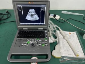 Untuk SUN-806A Sistem Diagnostik <span class=keywords><strong>Ultrasound</strong></span> Hitam Putih Berbasis PC Harga Terjangkau, Mesin <span class=keywords><strong>USG</strong></span> Digital Penuh dengan Layar 12.1 inci - Product Image 6