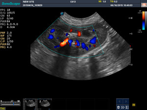 Ecógrafo Doppler Color Digital Portátil y Duradero Sonoscape S8 ExpV, Escáner Veterinario para Clínica y <span class=keywords><strong>Hospital</strong></span> - Product Image 6